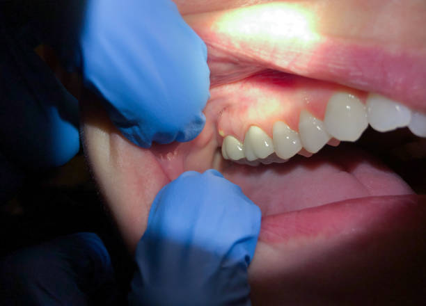 Best Same-Day Emergency Dental Services in Belle Haven, VA
