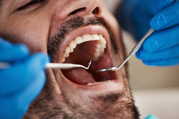 Best Emergency Treatment for Dental Infections or Abscesses in Belle Haven, VA