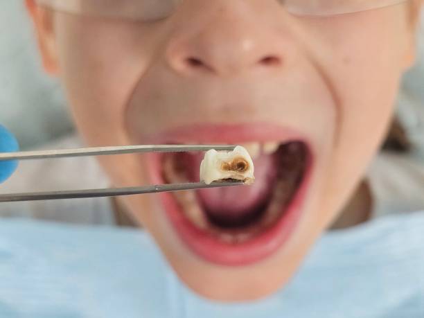 Best Weekend Emergency Dentist in Belle Haven, VA