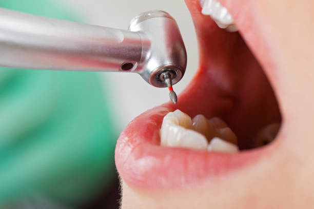 Best Emergency Tooth Extraction in Belle Haven, VA
